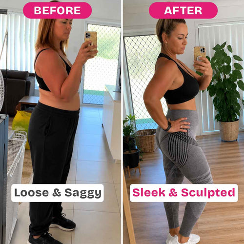 Anti-Cellulite Leggings